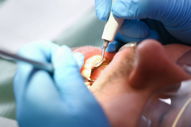 Best Emergency Treatment for Toothache in Moncks Corner, SC