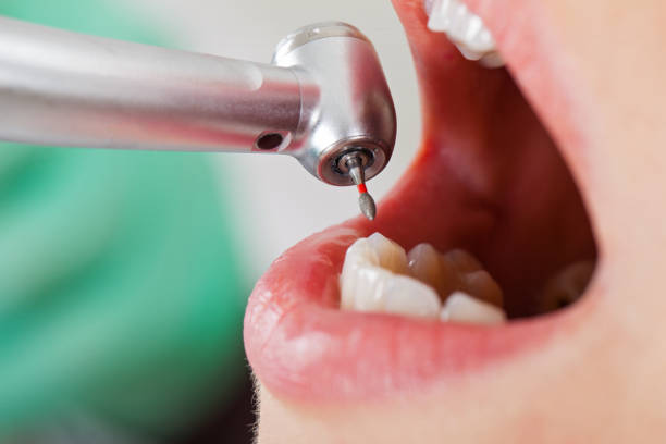 Best Walk-In Emergency Dentist in Moncks Corner, SC